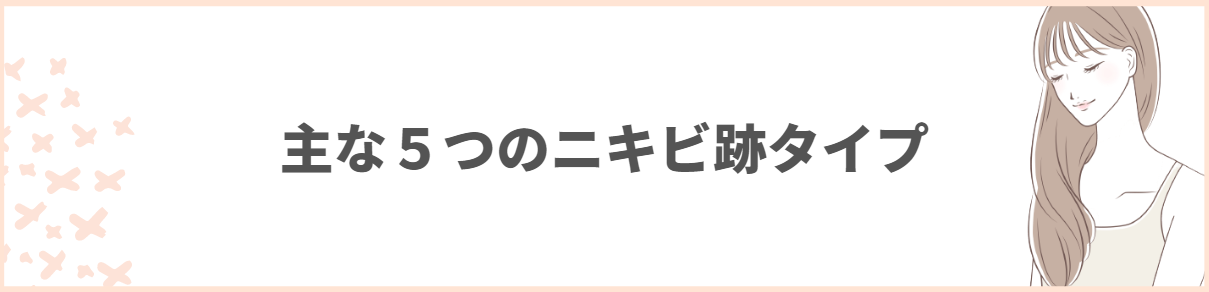 ニキビ跡_治療_5つのタイプ